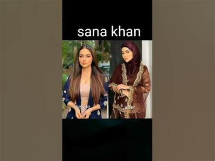 Sana Khan Plastic Surgery Before and After